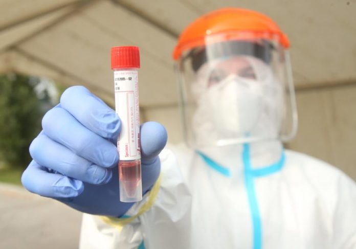 virus-korona-testiranje-02