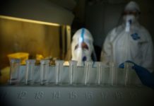 U Srpskoj još 379 zaraženih virusom korona, preminulo 18 lica