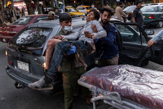 A person wounded in a bomb blast outside the Kabul airport in Afghanistan on Thursday, Aug. 26, 2021, arrives at a hospital in Kabul. (Victor J. Blue/The New York Times)